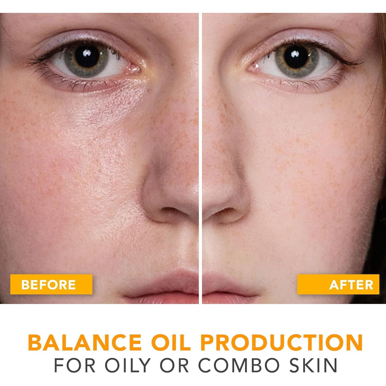 Hidratante Facial Controlador de Aceite Beauty by Earth 31g