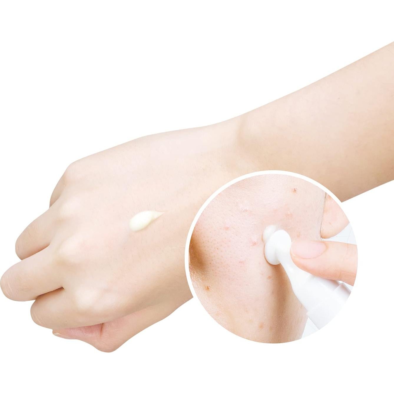 Crema Anti Acné YADAH Rojo Cero 15g - Vegana y Natural