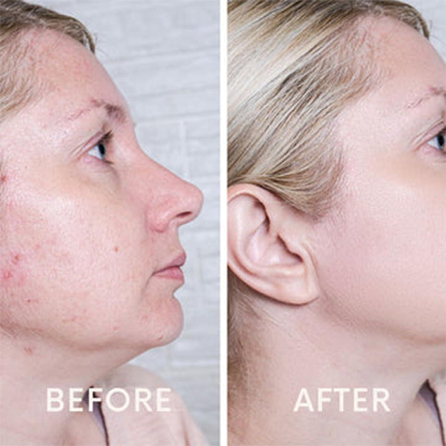 Suero Facial Iluminador Nizma 30 ml - Gel Hidratante Natural