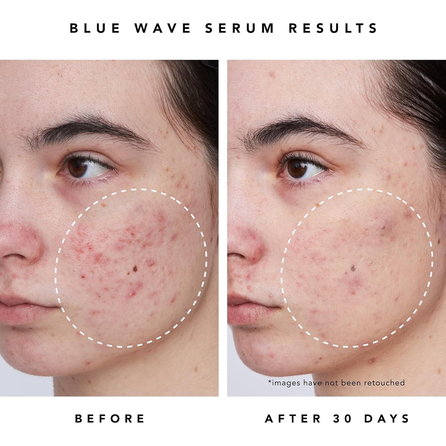 Suero Limpiador HERBIVORE 30mL - 2% Ácido Salicílico Vegano