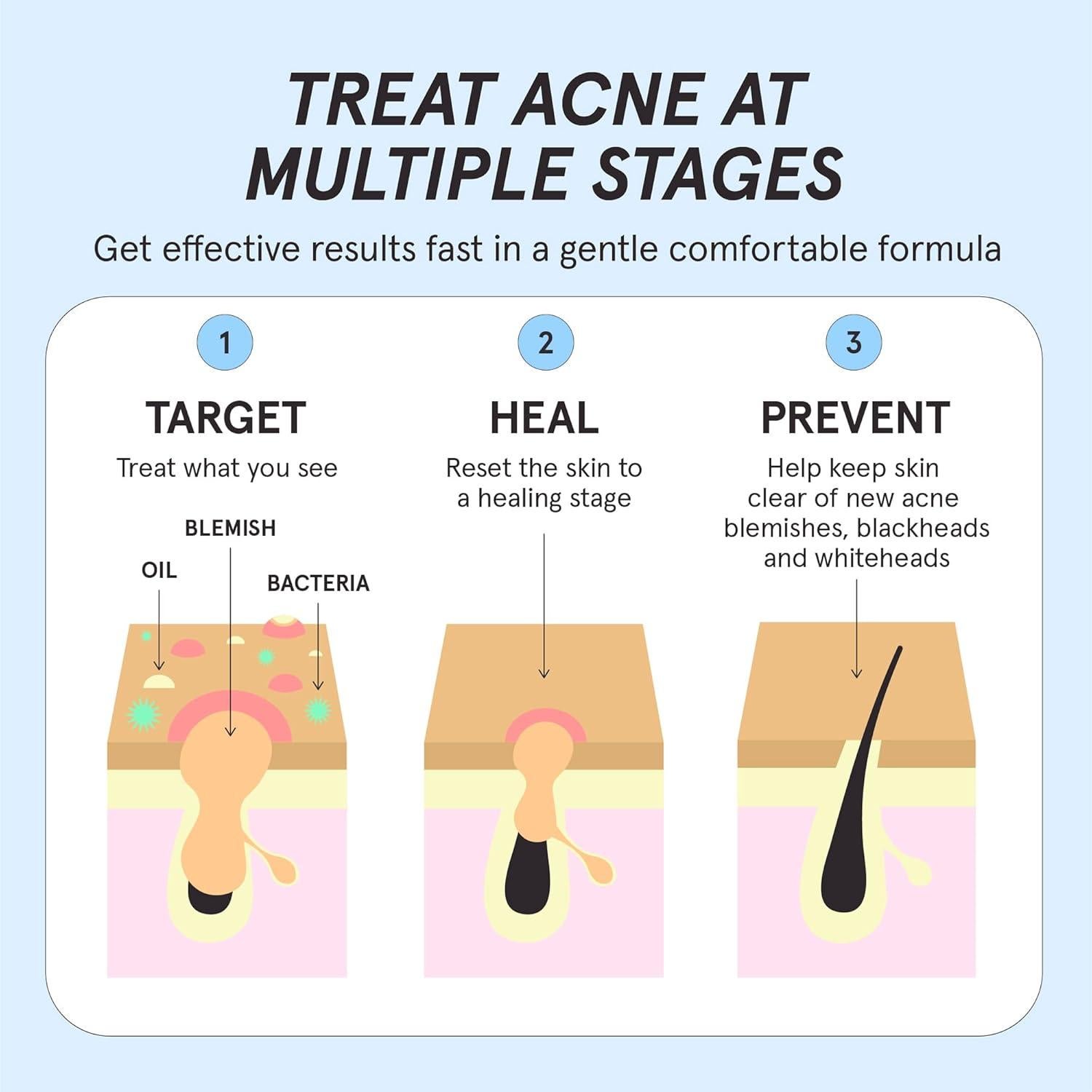 Suero Limpiador HERBIVORE 30mL - 2% Ácido Salicílico Vegano