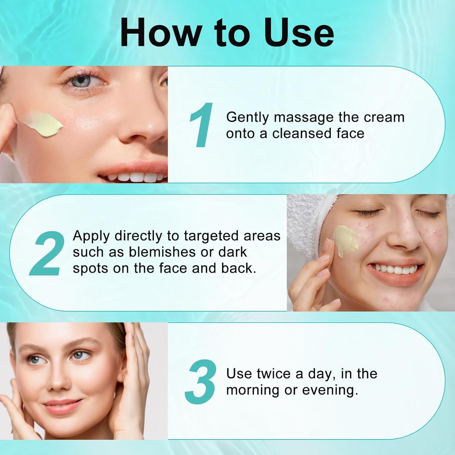 Crema Tratamiento Acné Quístico GUOYAOLIFU 132g - Natural