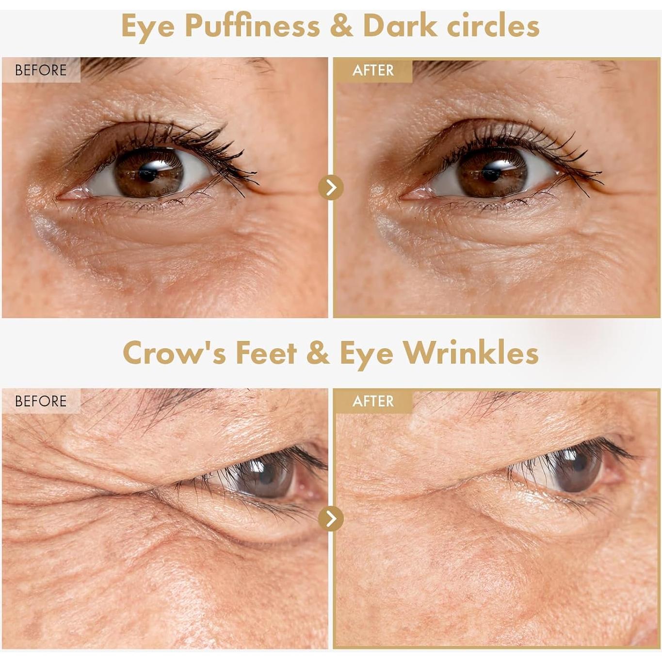 Suero para Ojos TOSOWOONG Ginseng Retinal 30ml Antiarrugas