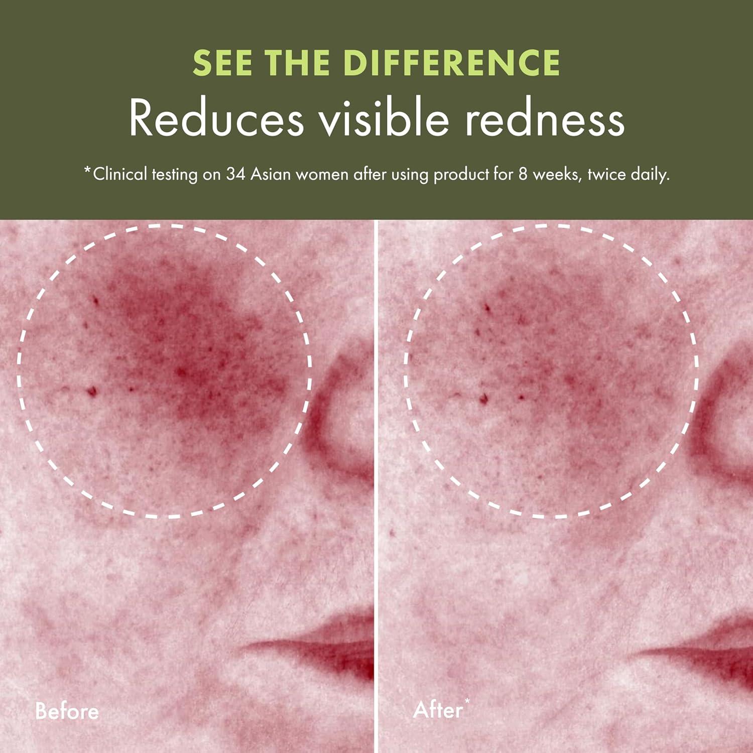 Loción Tratamiento Calmante Origins Mega-Hongo 198.45 ml