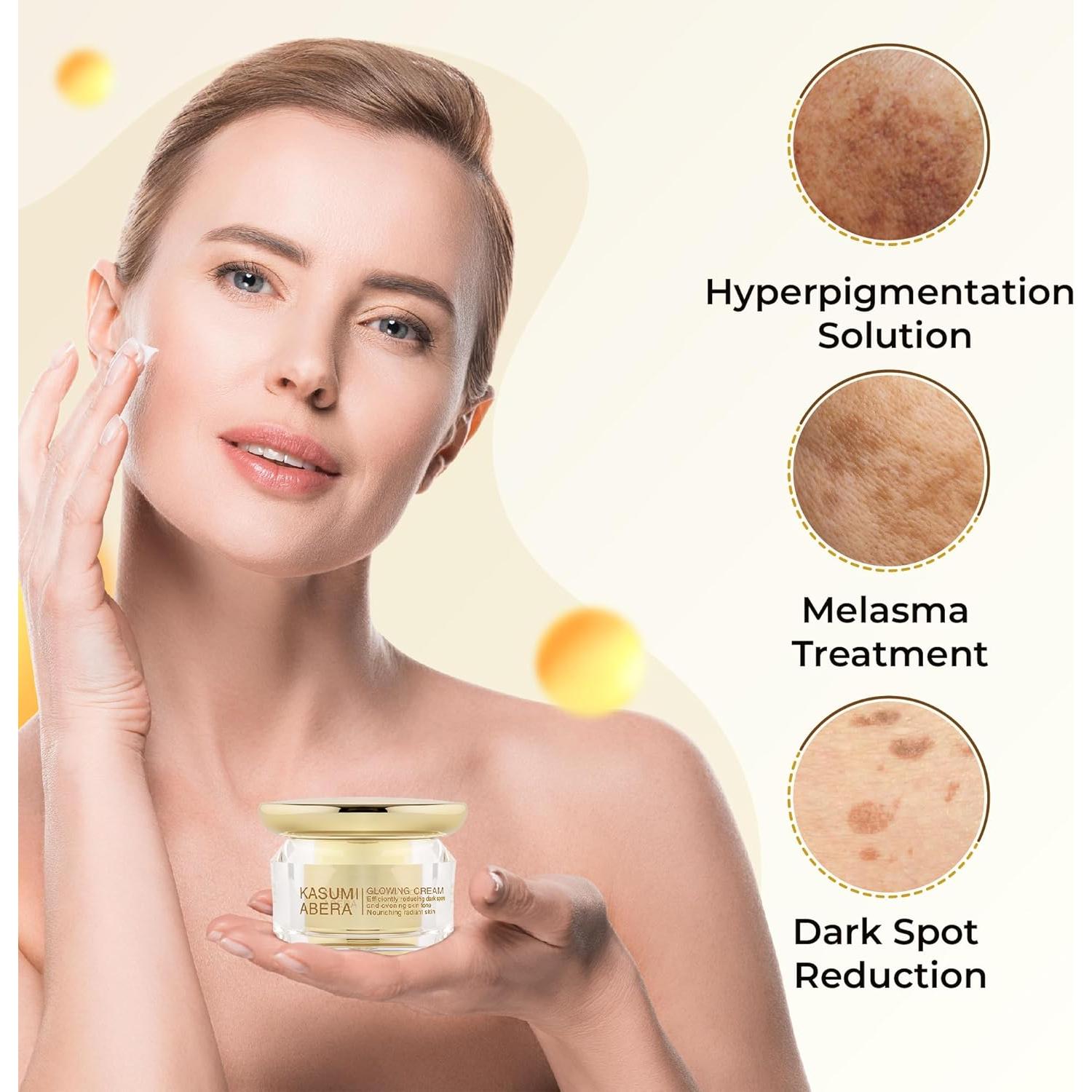 CREMA ABERA Kasumi para Melasma y Manchas Oscuras 19.84g