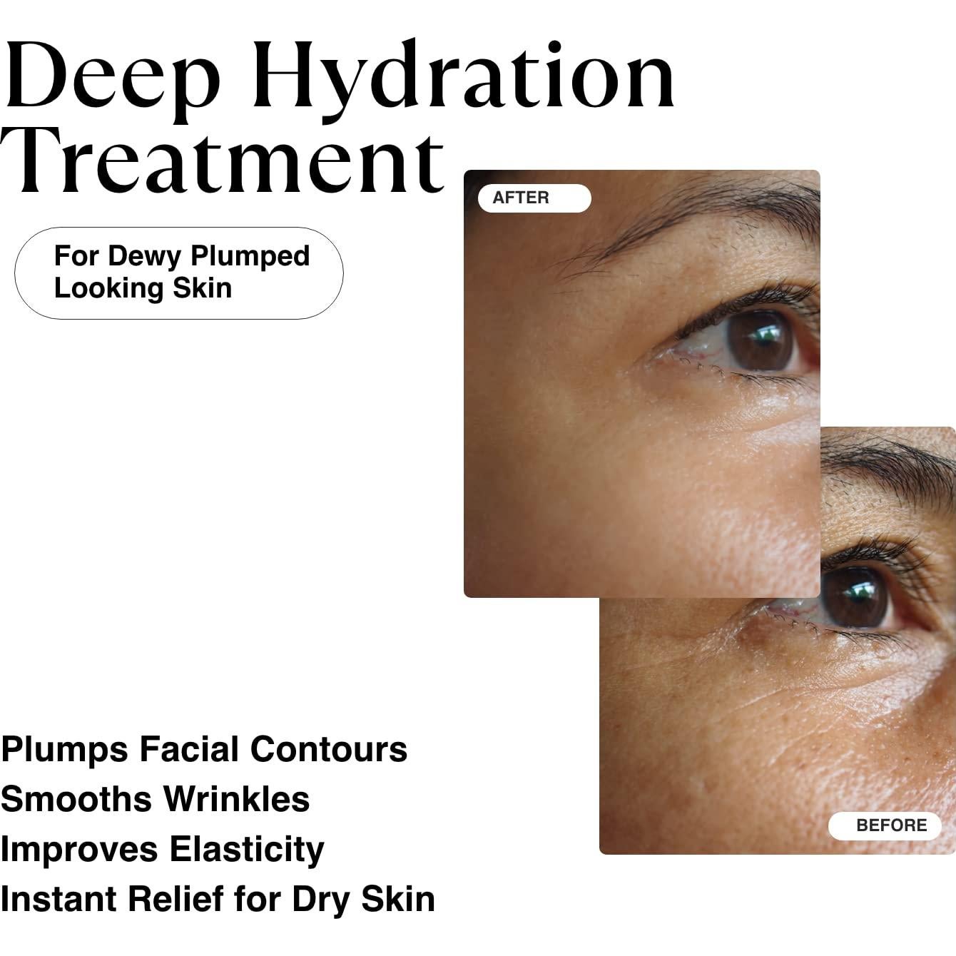 Sérum Hidratante Matkas 30 ml - Ácido Hialurónico y Niacinamida