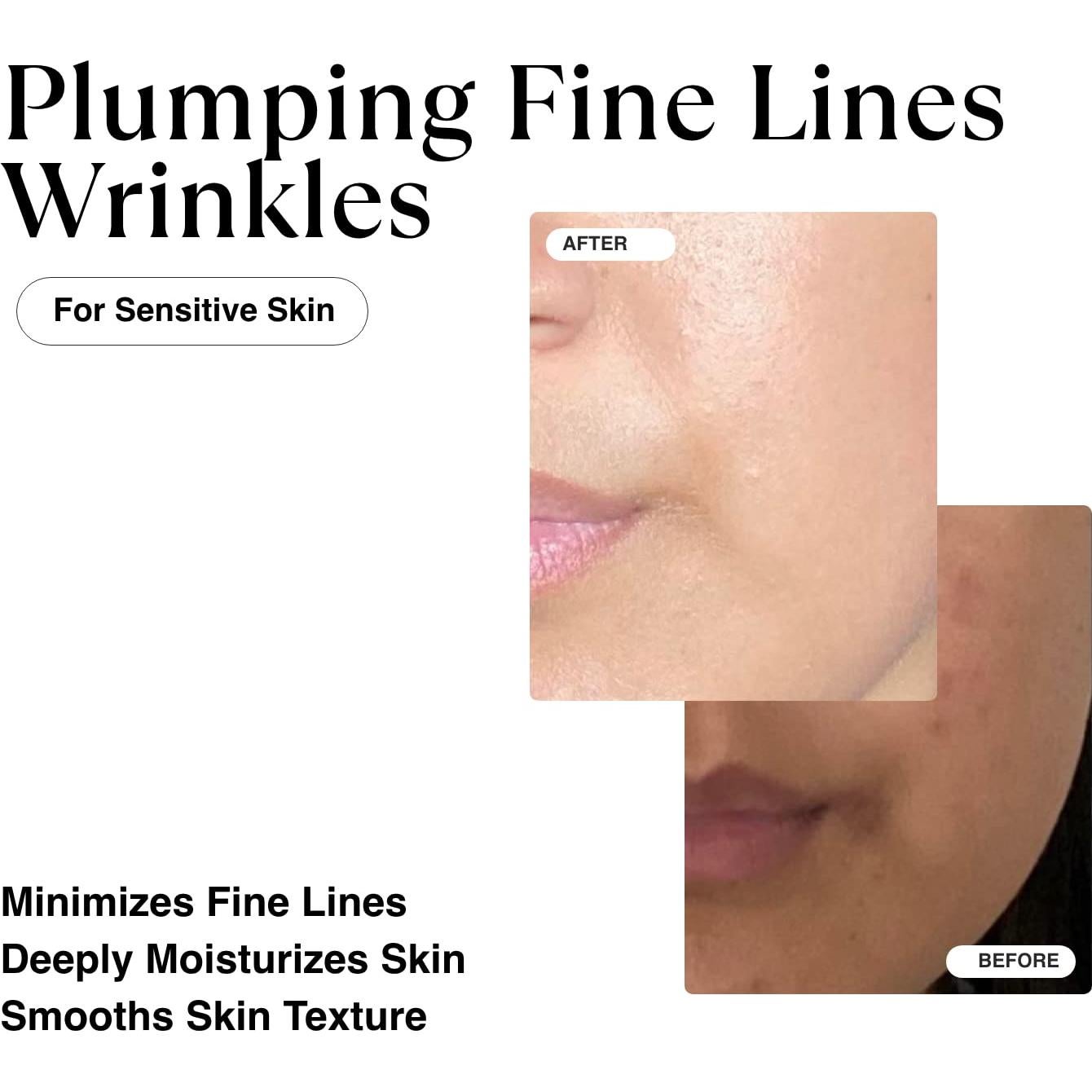 Sérum Hidratante Matkas 30 ml - Ácido Hialurónico y Niacinamida