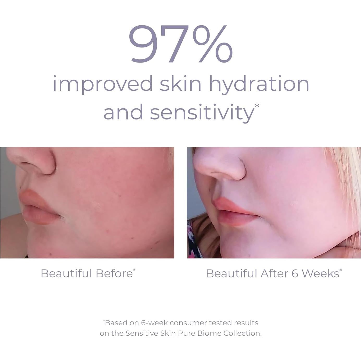 Crema Facial Equilibrante Derma E Pure Biome 56.7 g