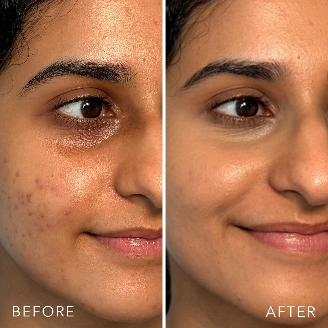 Corrector de Suero Hidratante Doll 10 con Hongo Reishi 30ml