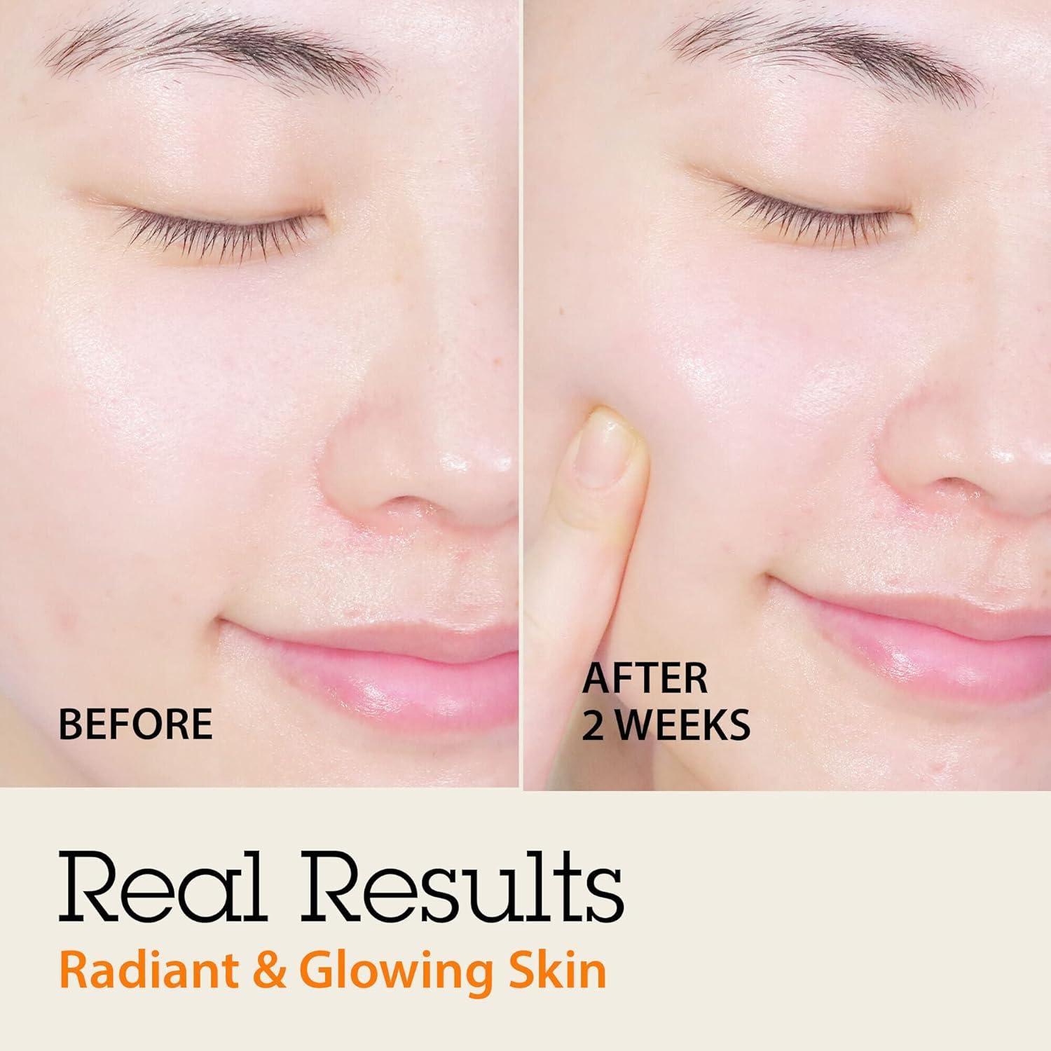 Conjunto Suero Facial Blithe Chaga Tundra y Albaricoque 49.8ml