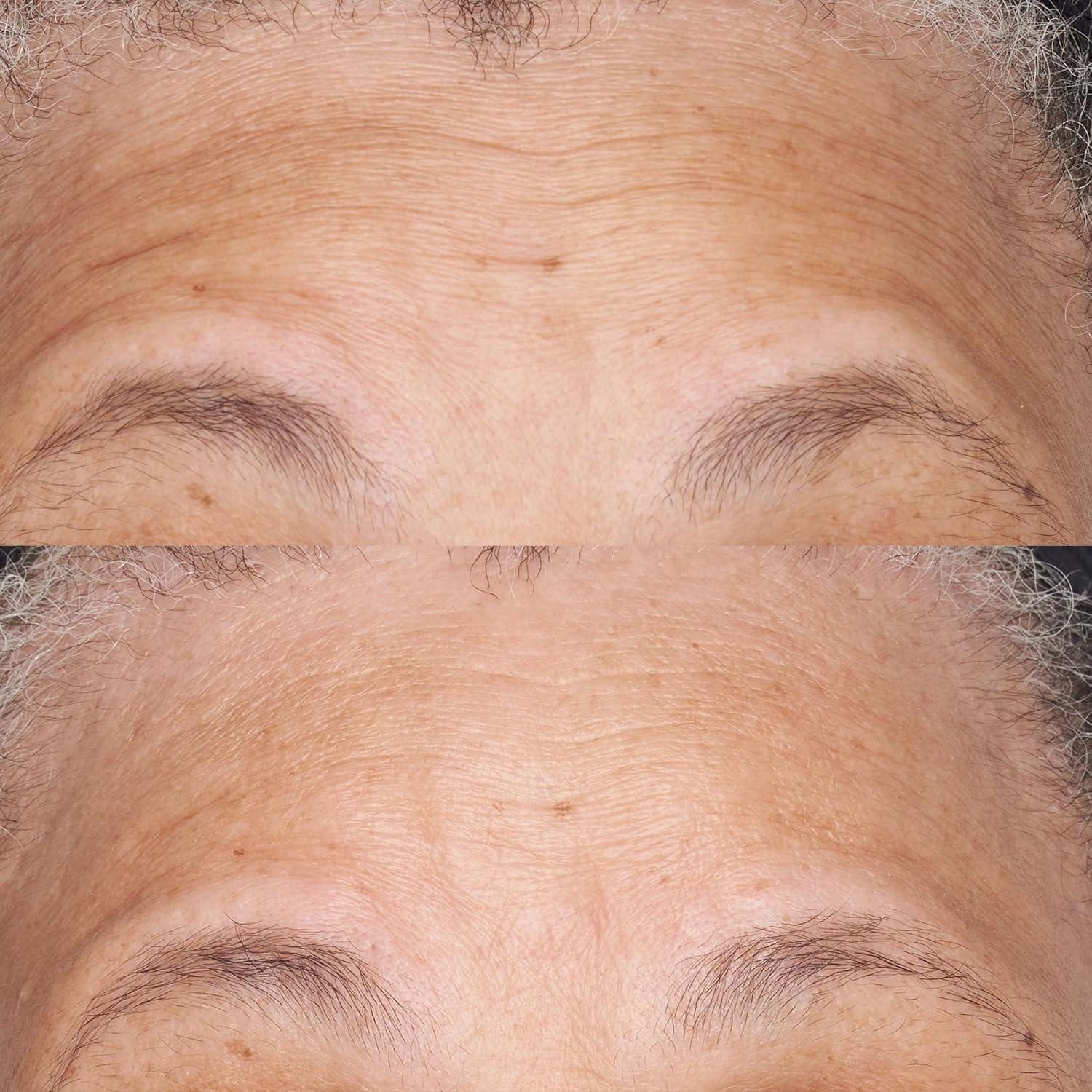 Hidratante Nutritivo Reparador Perricone MD 59 ml Hipoalergénico