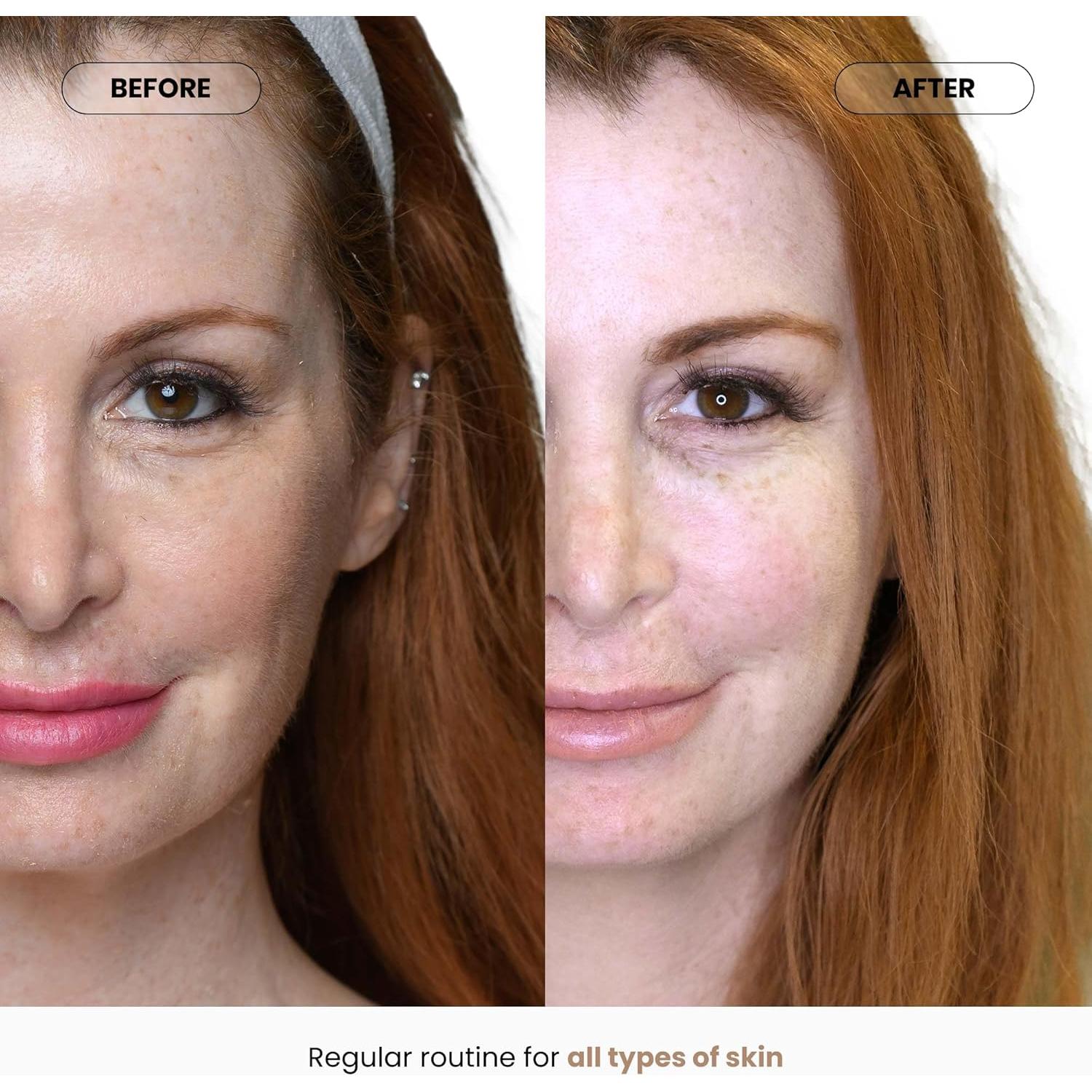 Gel de Carboxi CO2Lift Lumisque - Máscara Facial Hidratante