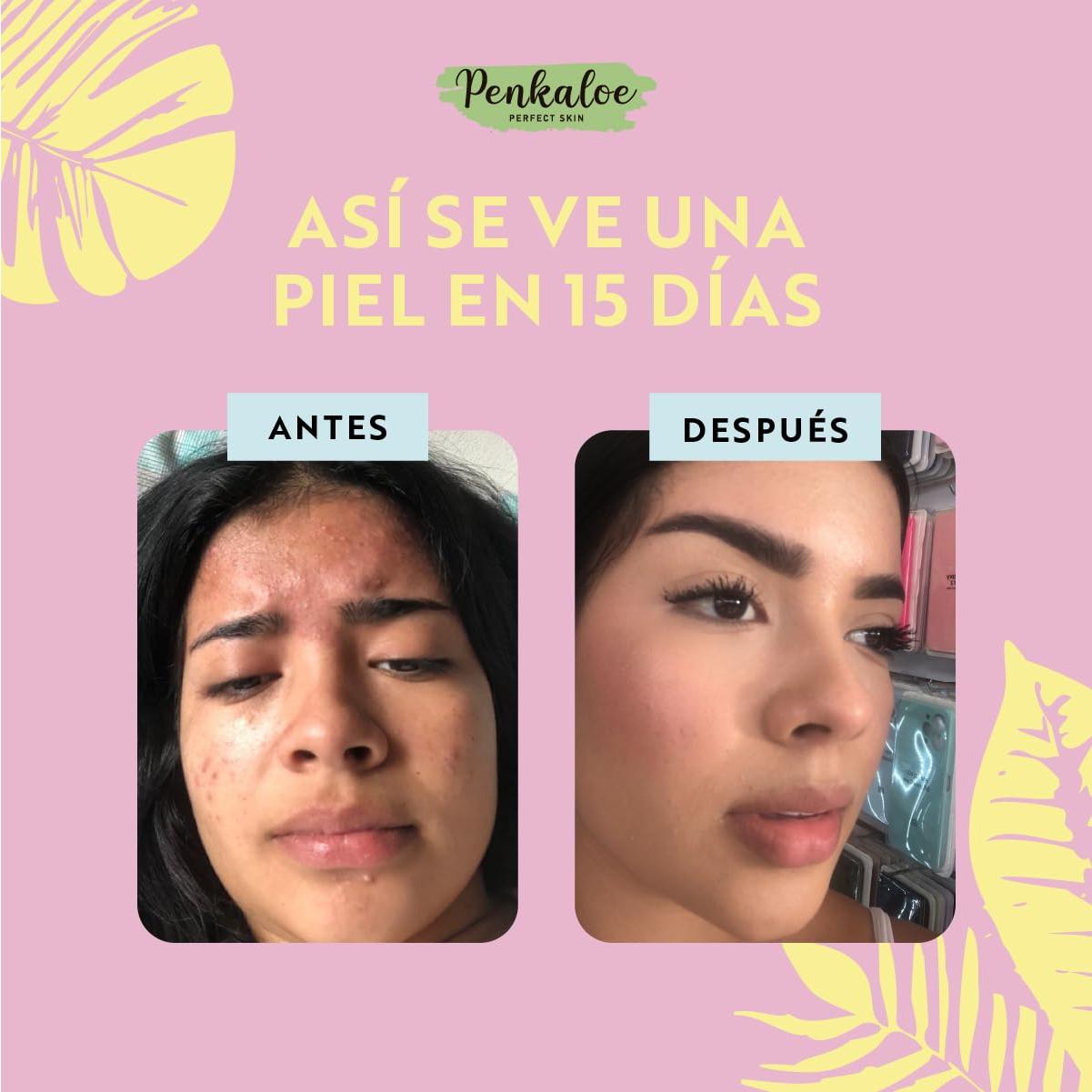 Gel de Aloe Vera Penkaloe 120 g con Niacinamida y Ácido Hialurónico