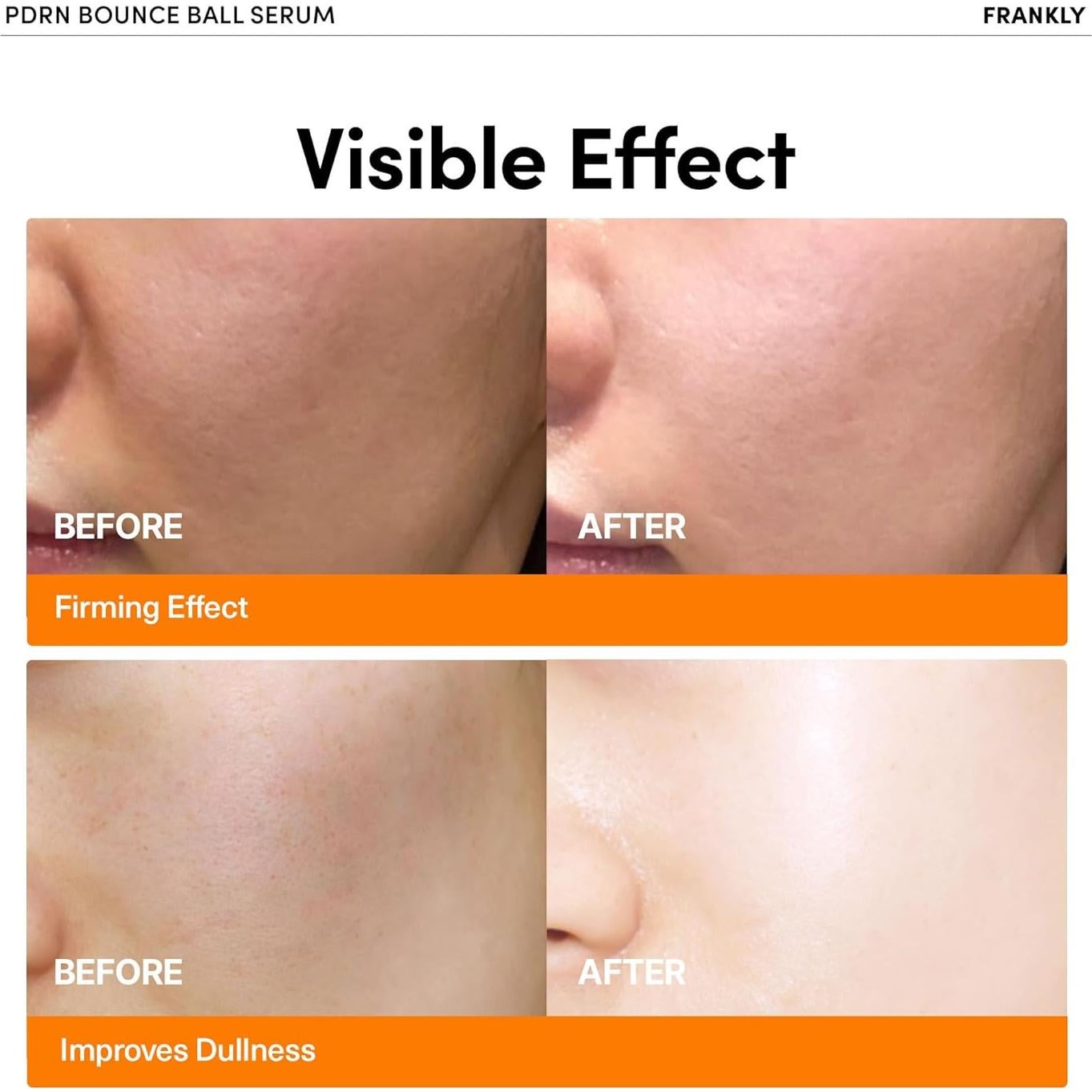 Sérum PDRN Frankly 30ml - Suero de ADN de Salmón para Piel Radiante