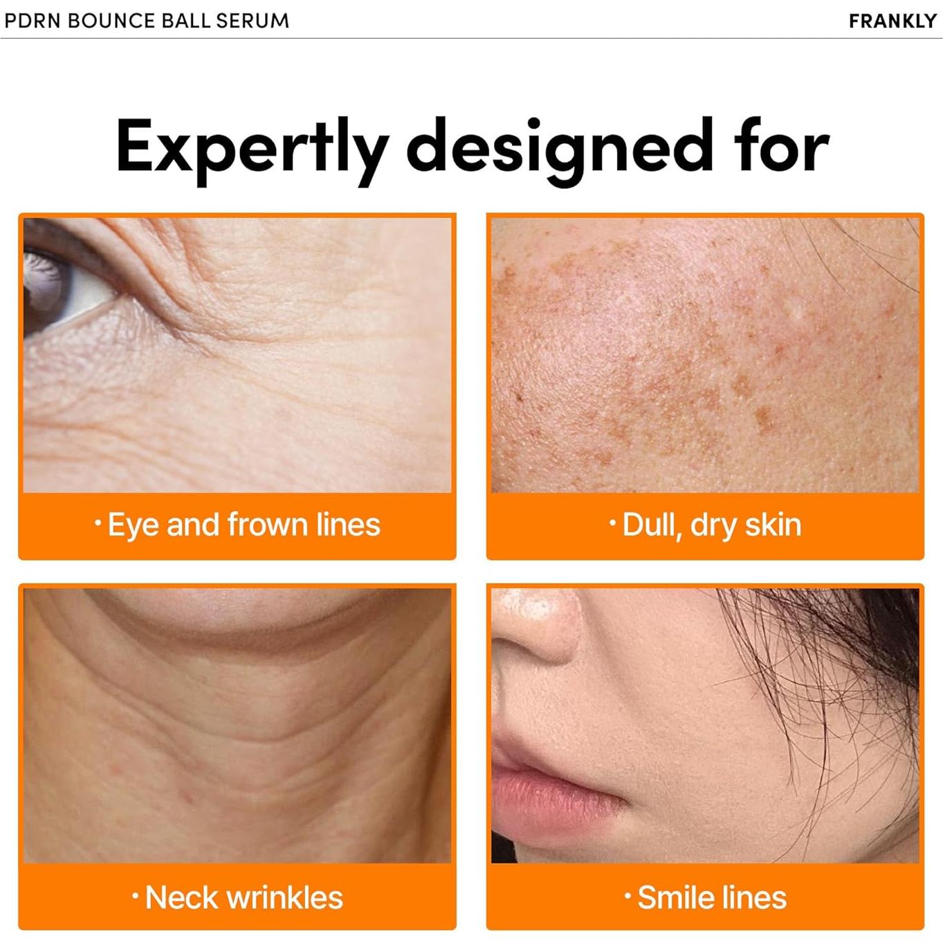 Sérum PDRN Frankly 30ml - Suero de ADN de Salmón para Piel Radiante