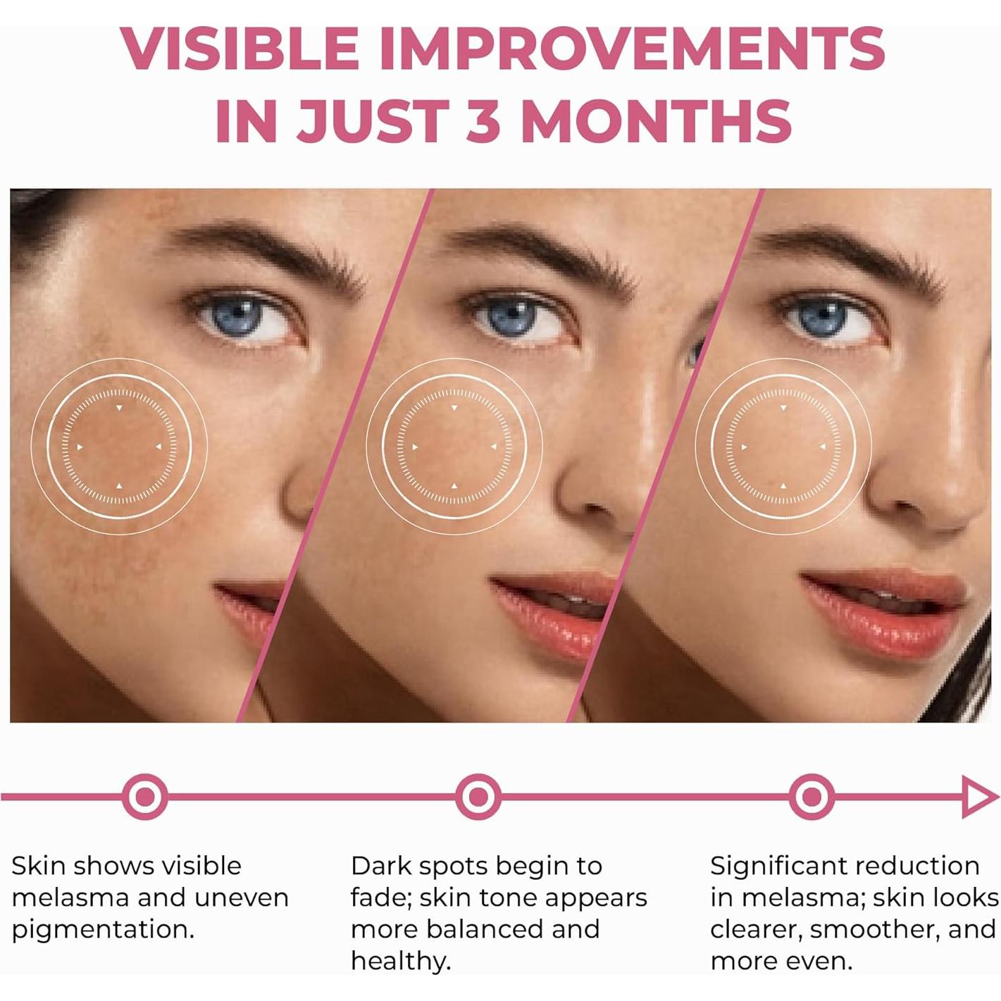 Suero Renovador de Piel ABERA 30 ml - Antienvejecimiento y Melasma