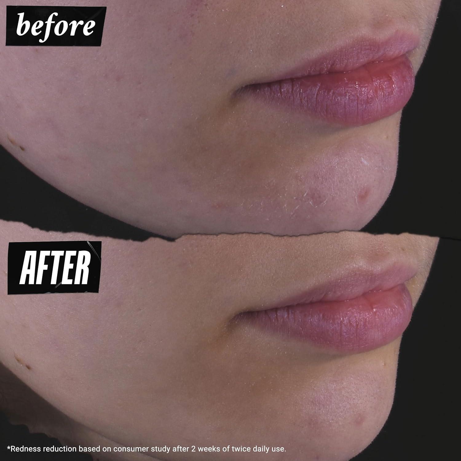 Tónico Facial Calmante Kiehl's Caléndula 125 ml Sin Alcohol