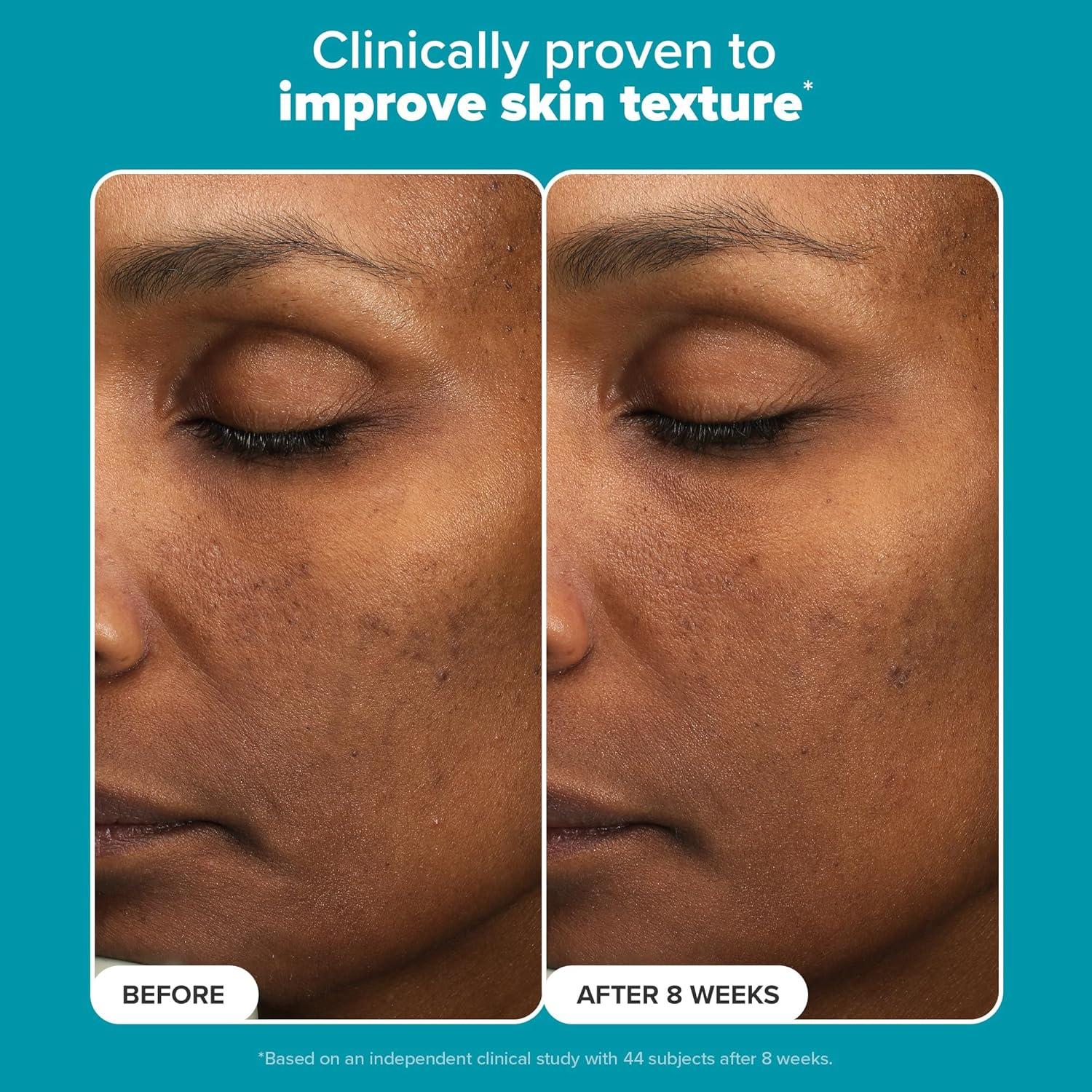 Exfoliante AHA Paula's Choice 30 ml - Ácido Mandélico 6% y Láctico 2%