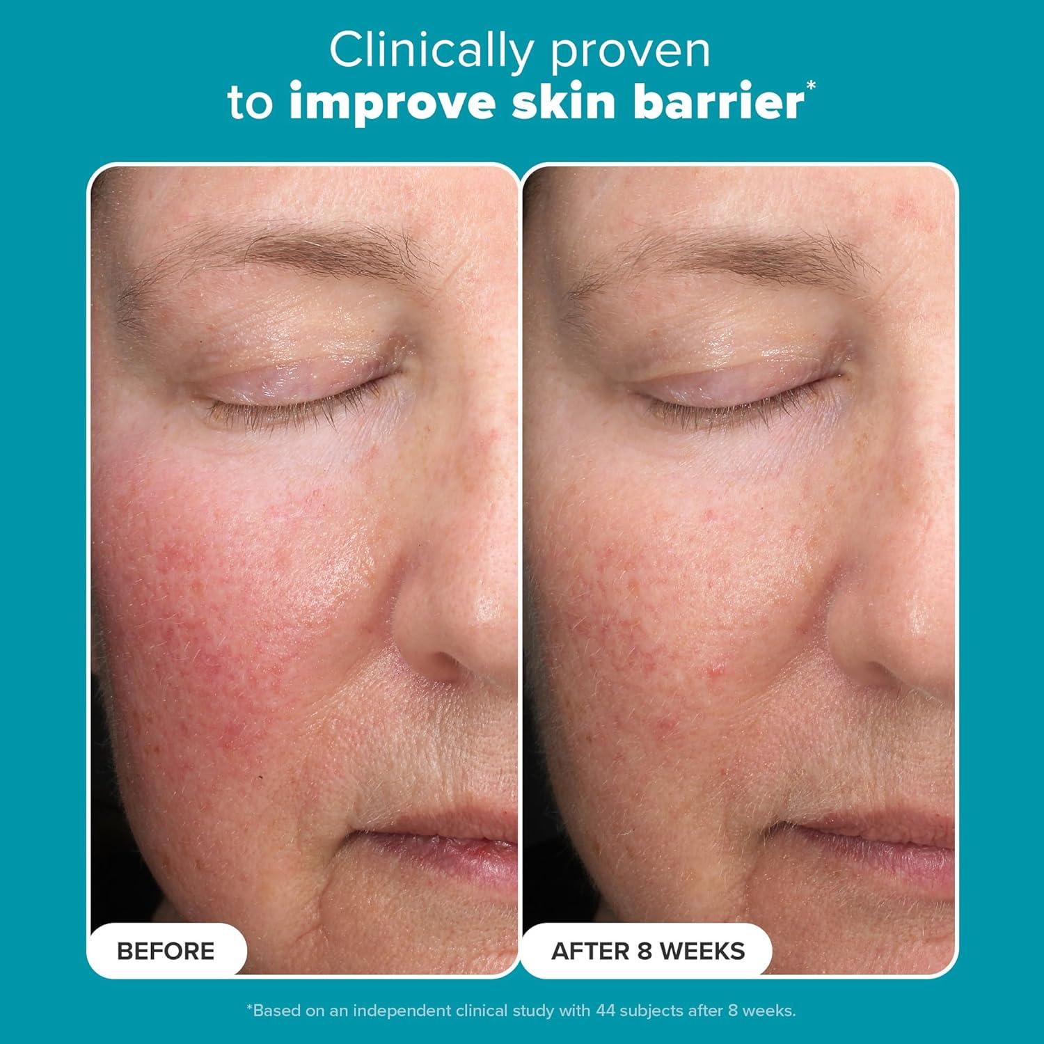 Exfoliante AHA Paula's Choice 30 ml - Ácido Mandélico 6% y Láctico 2%