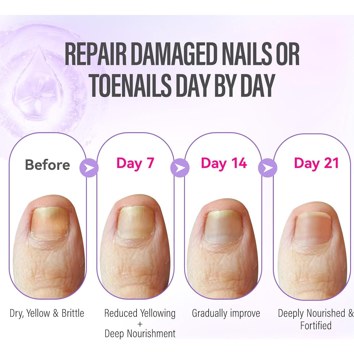 Aceite Reparador para Pies Secos y Agrietados - Aroma Lavanda