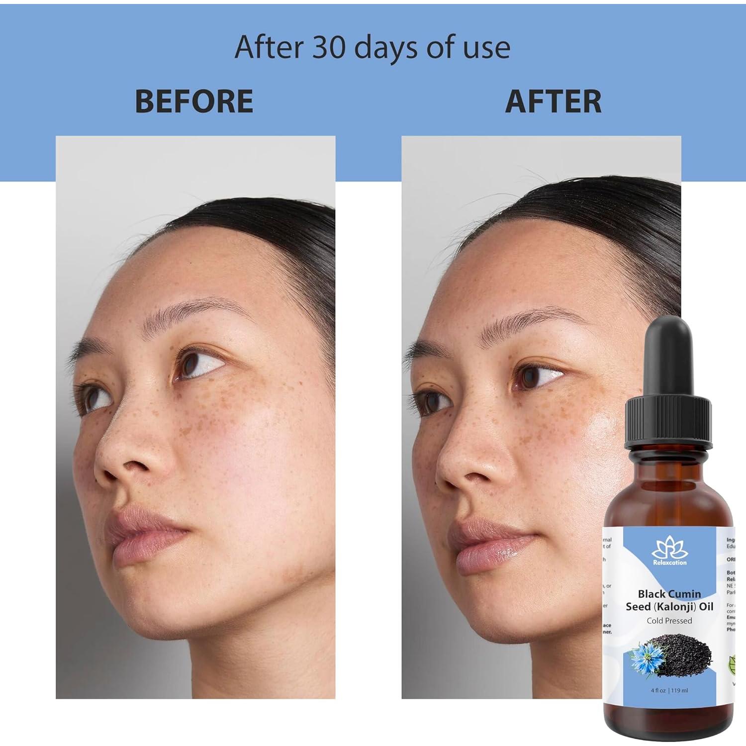 Aceite de Semilla de Comino Negro Orgánico Relaxcation 28.35 ml