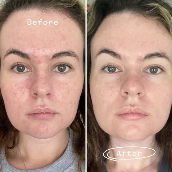 Aceite Facial Detoxificante PAI SKINCARE Carbon Star 30 ml