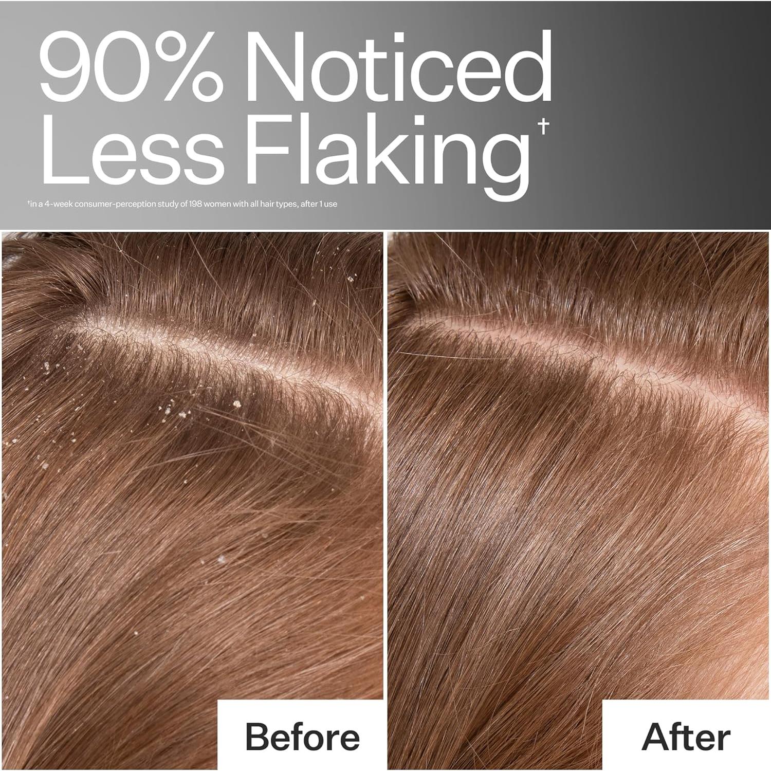 Aceite Detoxificante Act+Acre para Cuero Cabelludo 45g