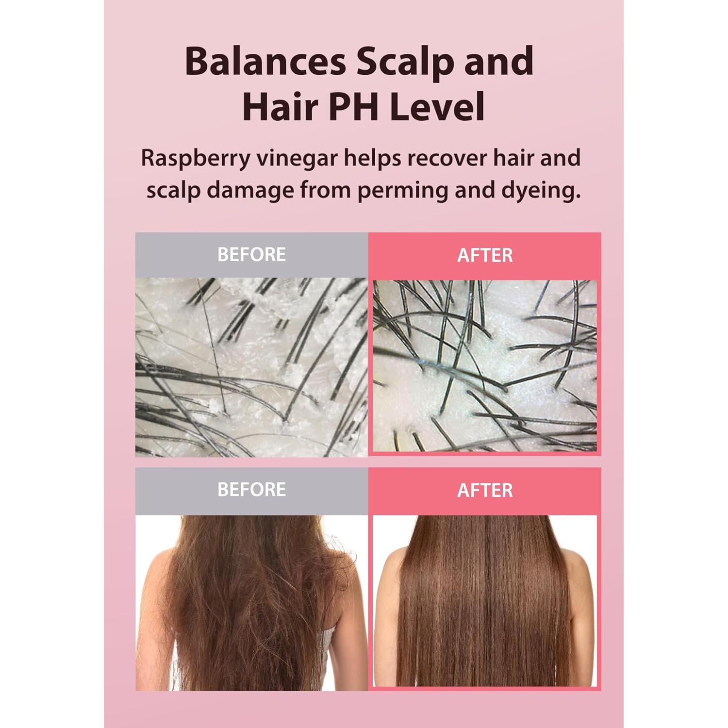 Champú A'PIEU de Vinagre de Frambuesa 500 ml - Anticaspa y Cuidado del Cabello