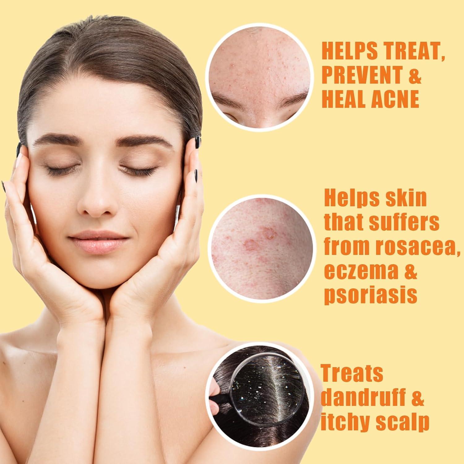 Barra de Jabón de Azufre 10% Natrulo - Limpiador Facial Natural