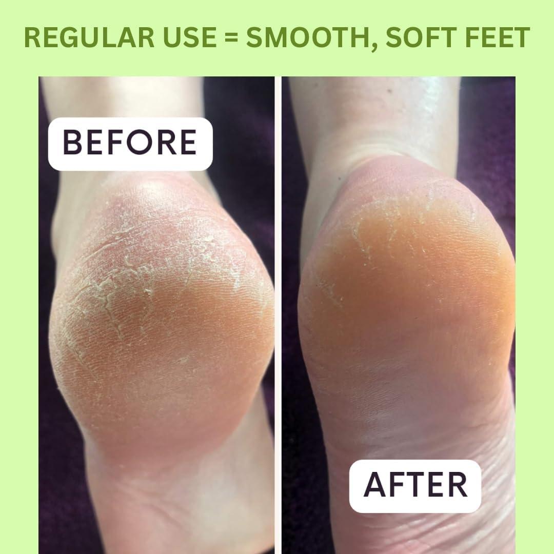 Kit de Cuidado de Pies Get Fresh 3 Pasos con Aroma a Hierba Limón