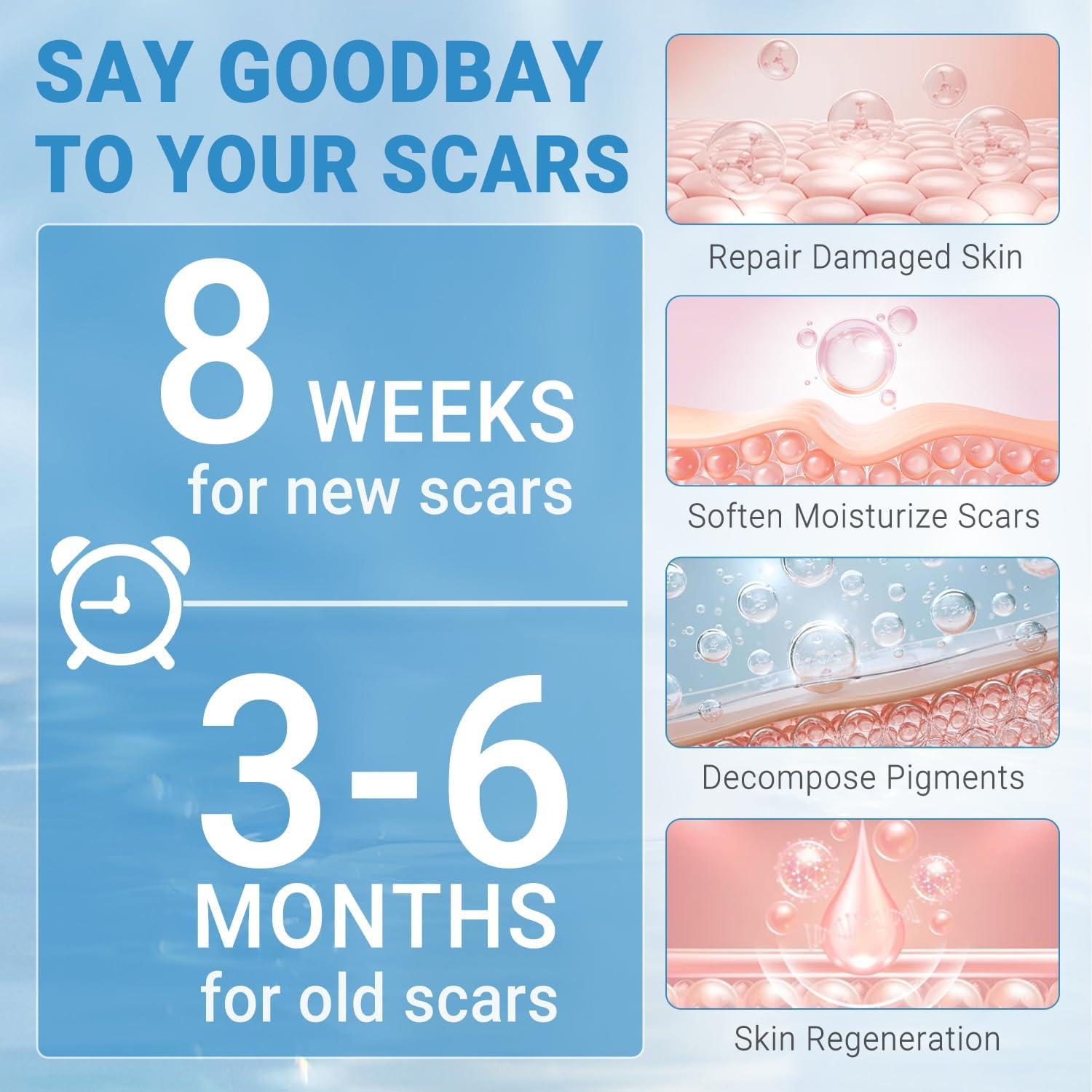 Gel de Cicatrices de Silicona Kunyle 20g - Eliminación de Queloides y Estrías