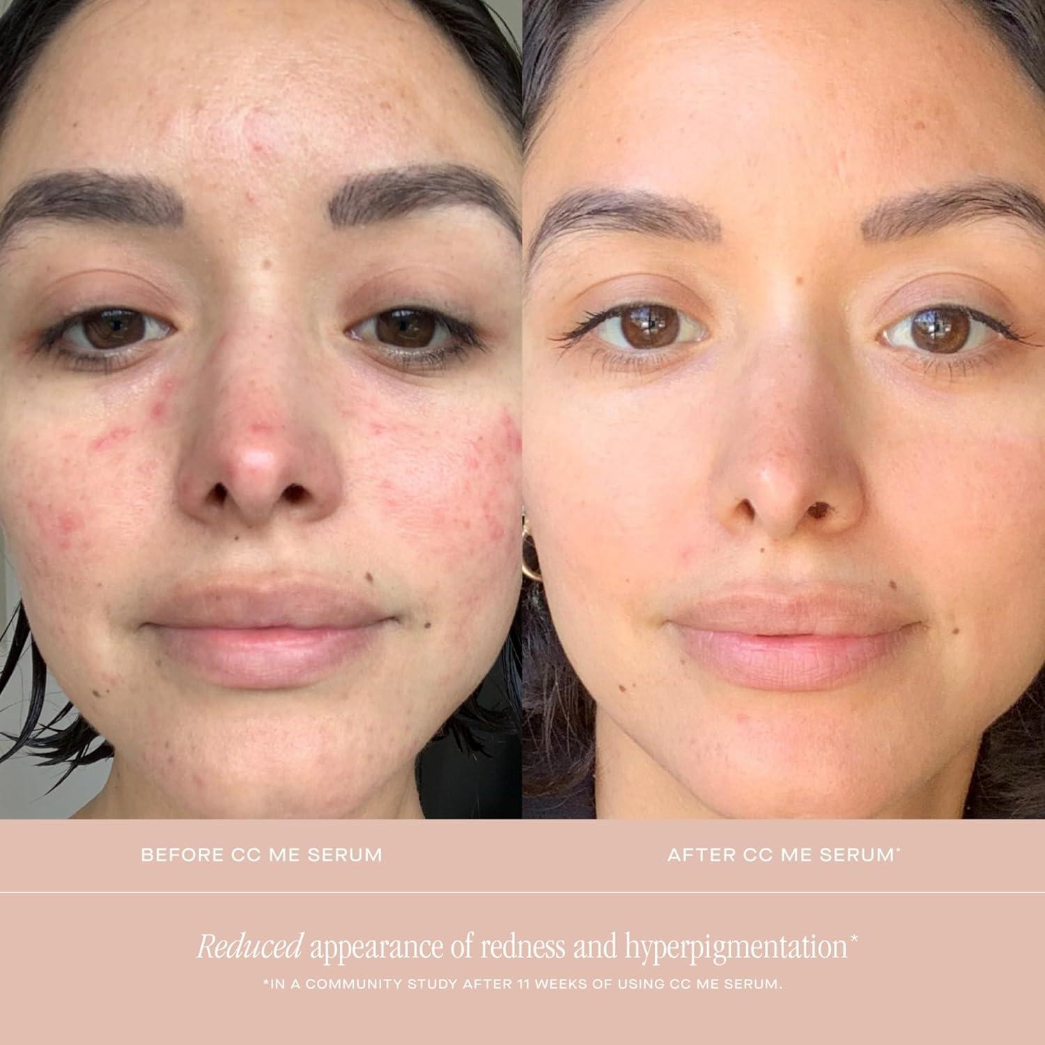 Suero Facial Iluminador Veranos de Verano 29.57 ml Vitamina C