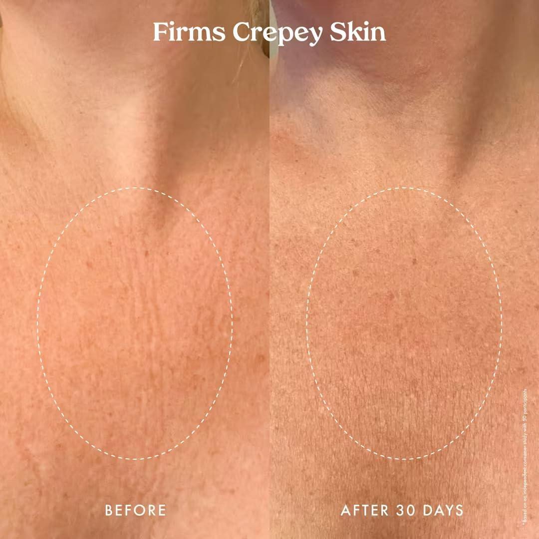 Crema Corporal Renovadora Ultra Retinol Kopari 118.3 ml