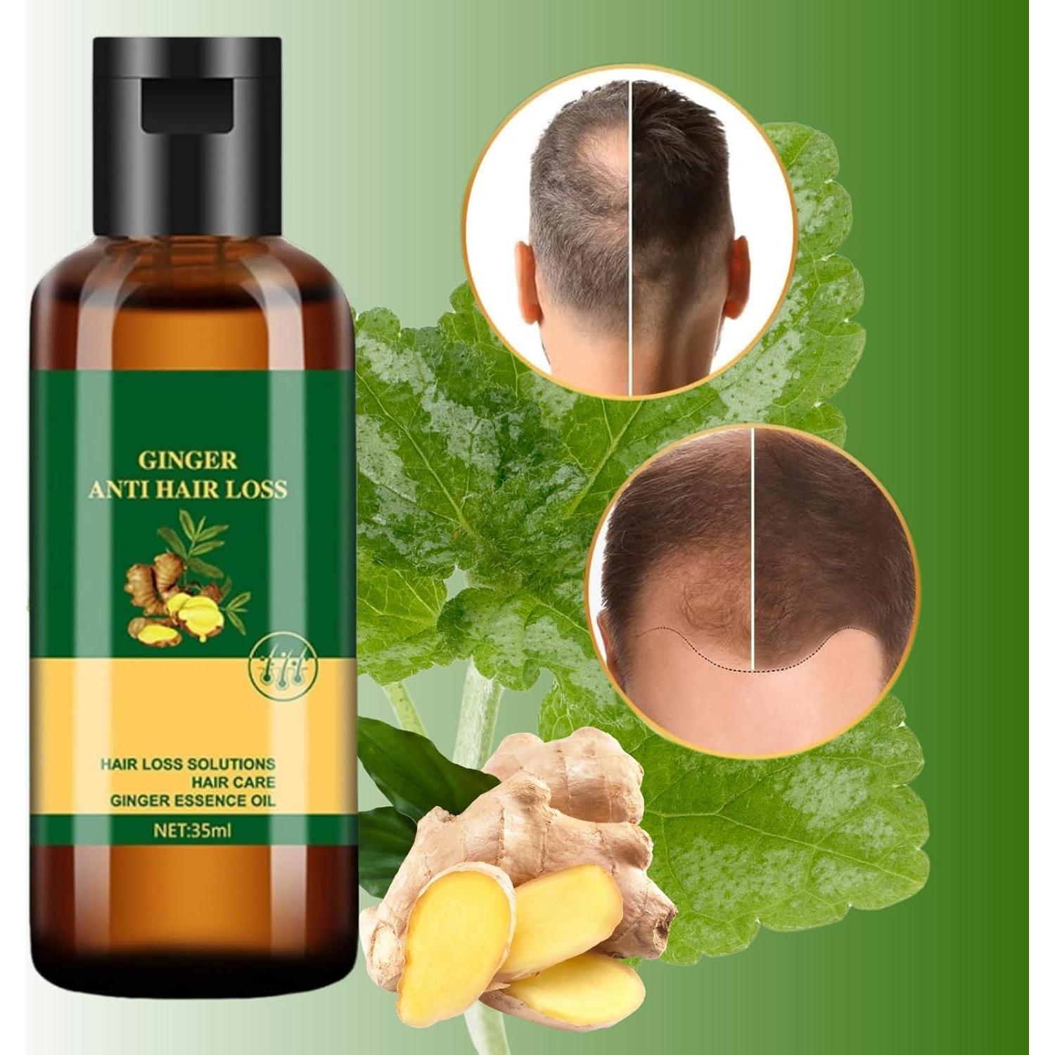 Aceite Esencial de Jengibre Aiwen Chen 2x35ml - Anti Caída