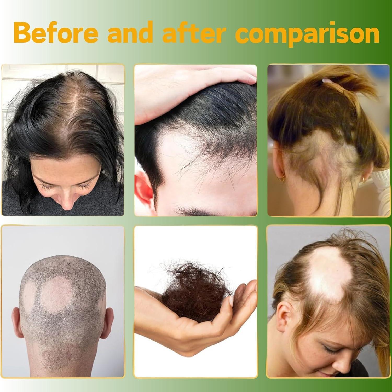 Aceite Esencial de Jengibre Aiwen Chen 2x35ml - Anti Caída