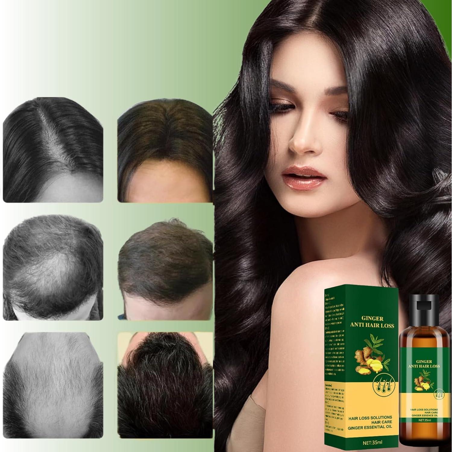 Aceite Esencial de Jengibre Aiwen Chen 2x35ml - Anti Caída