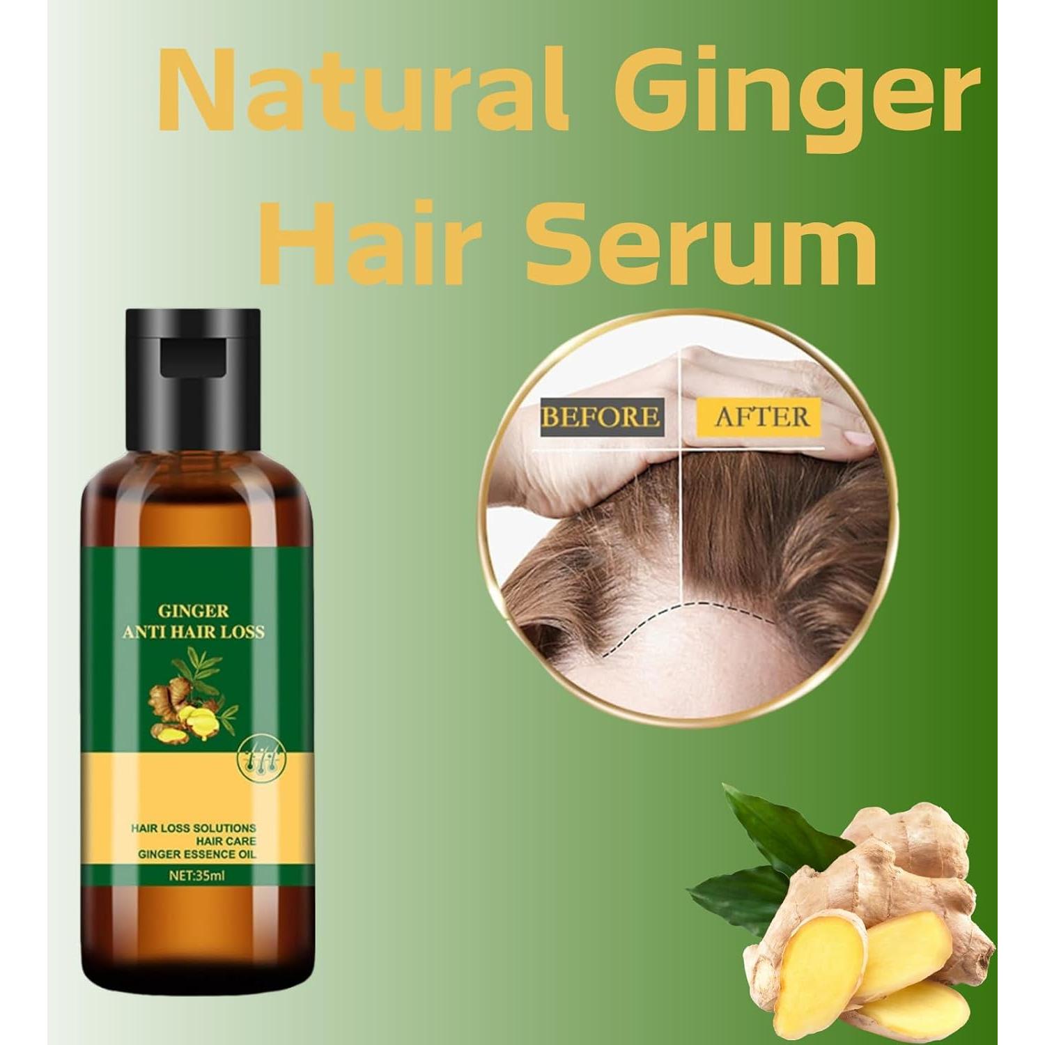 Aceite Esencial de Jengibre Aiwen Chen 2x35ml - Anti Caída