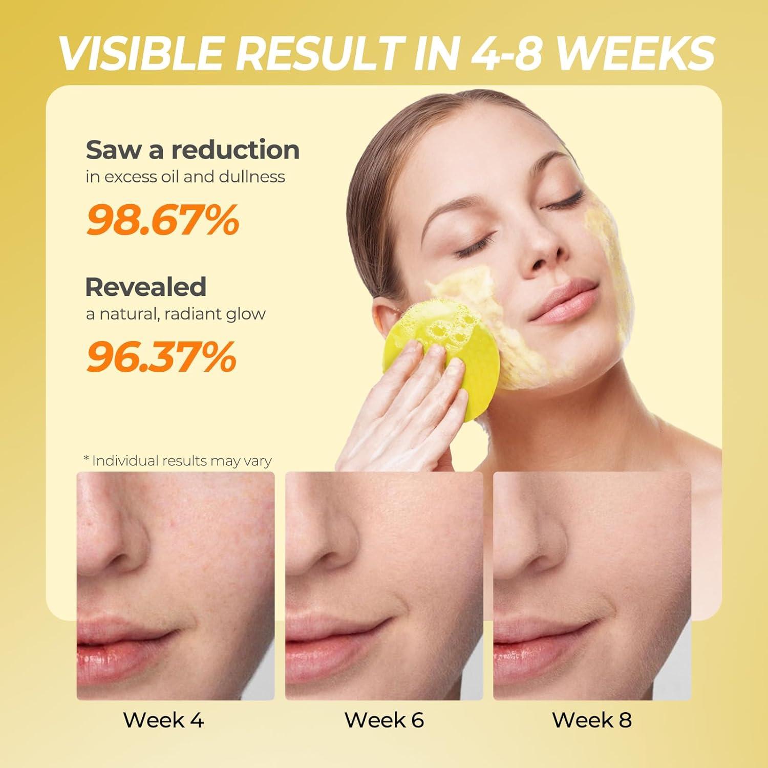 Discos Limpiadores de Cúrcuma y Ácido Kójico - 50 Pcs