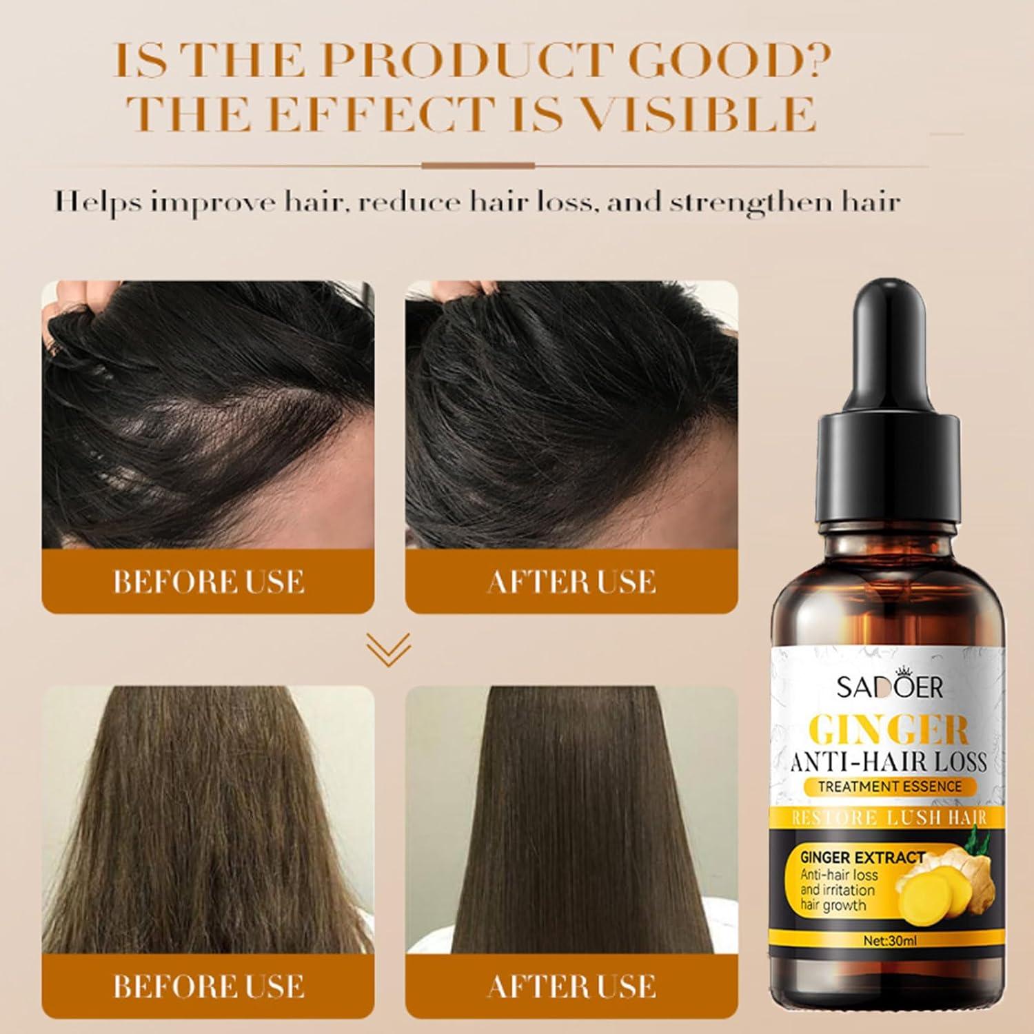 Aceite de Tratamiento de Jengibre GCDAT - 2 Unidades para Crecimiento y Hidratación del Cabello