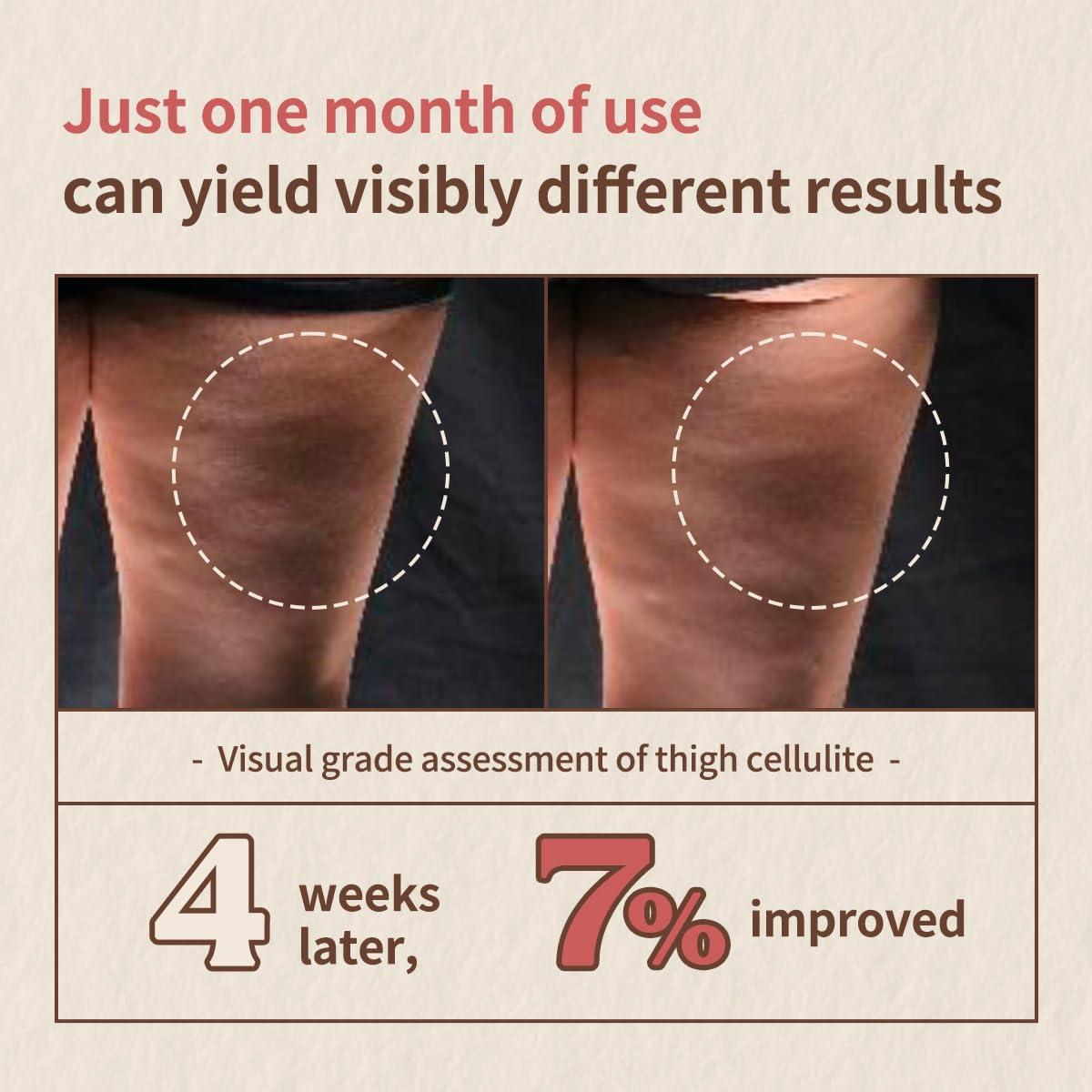 Loción Corporal Anticelulitis Nut Slim Fit 200ml - Cuidado Coreano