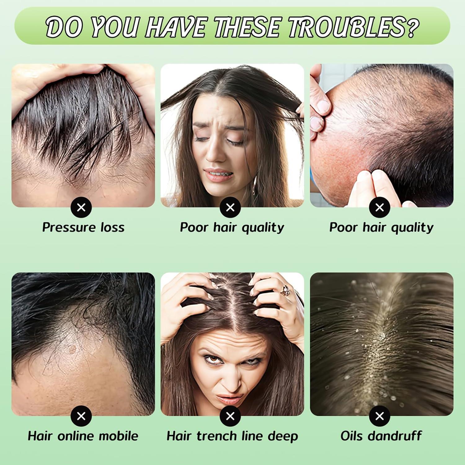 Champú Anticaída Yousheme con Extracto de Jengibre 40 Piezas