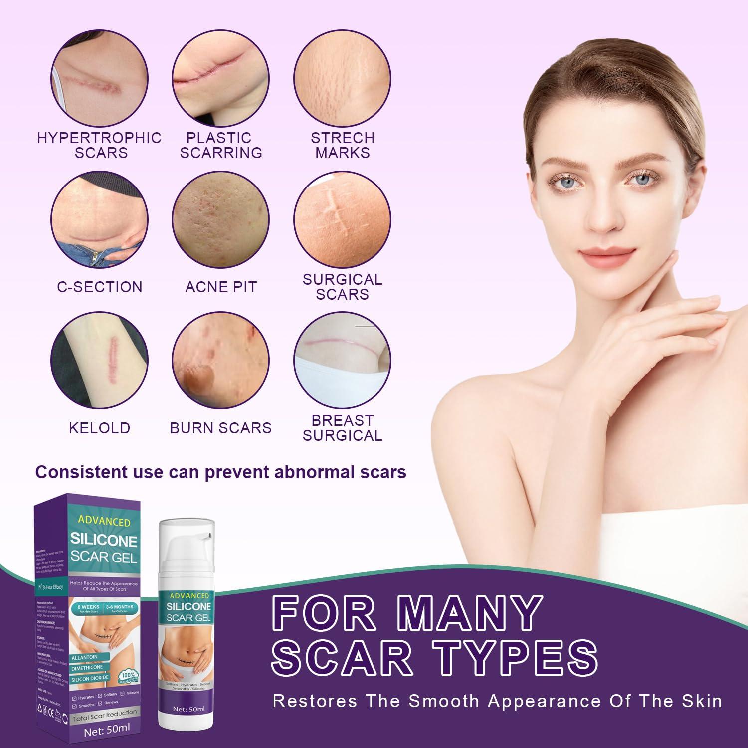 Crema de Cicatrices de Silicona Tearich 50g - Tratamiento Avanzado