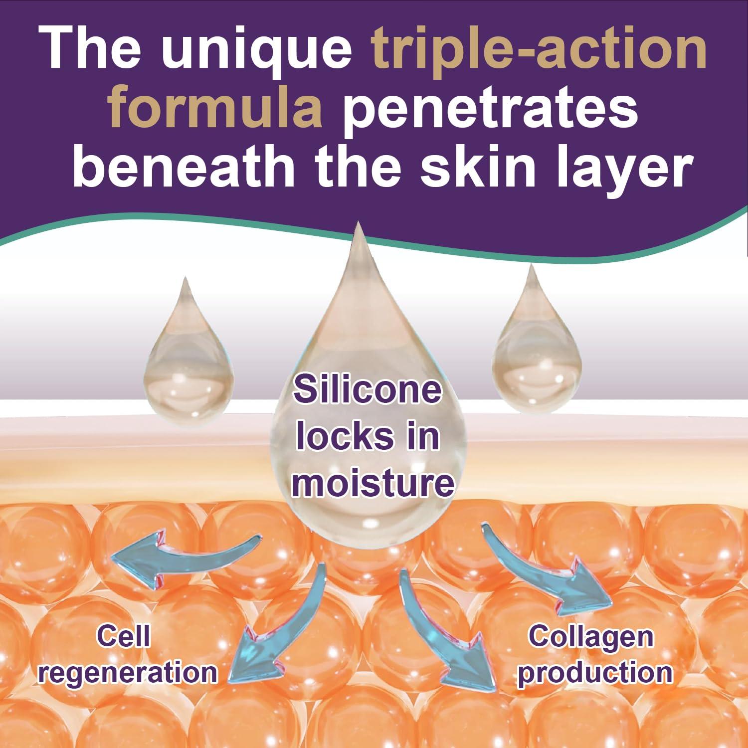 Crema de Cicatrices de Silicona Tearich 50g - Tratamiento Avanzado