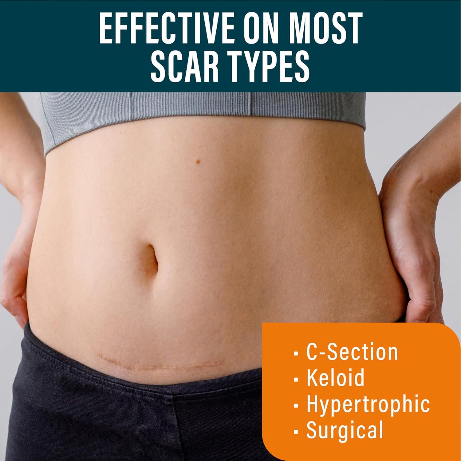 Crema Intensiva para Cicatrices NUVADERMIS 39.7 ml - Hidratante Nocturna