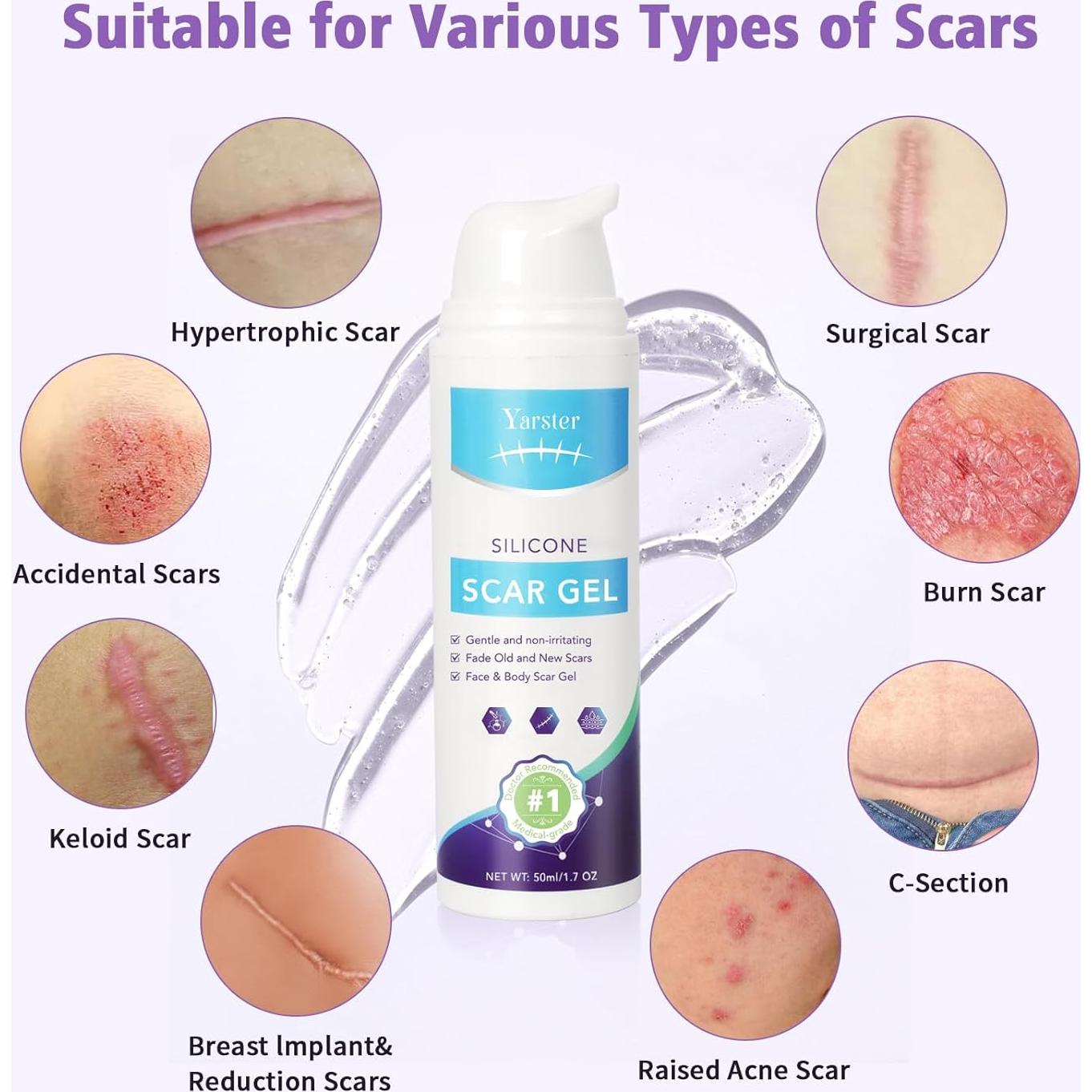Gel de Cicatrices de Silicona Yarster 50ml - Tratamiento Avanzado