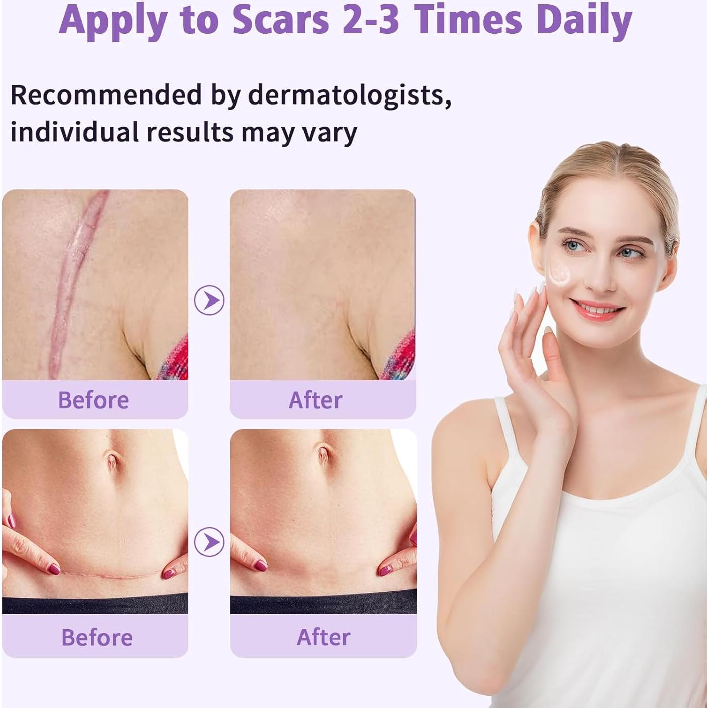 Gel de Cicatrices de Silicona Yarster 50ml - Tratamiento Avanzado