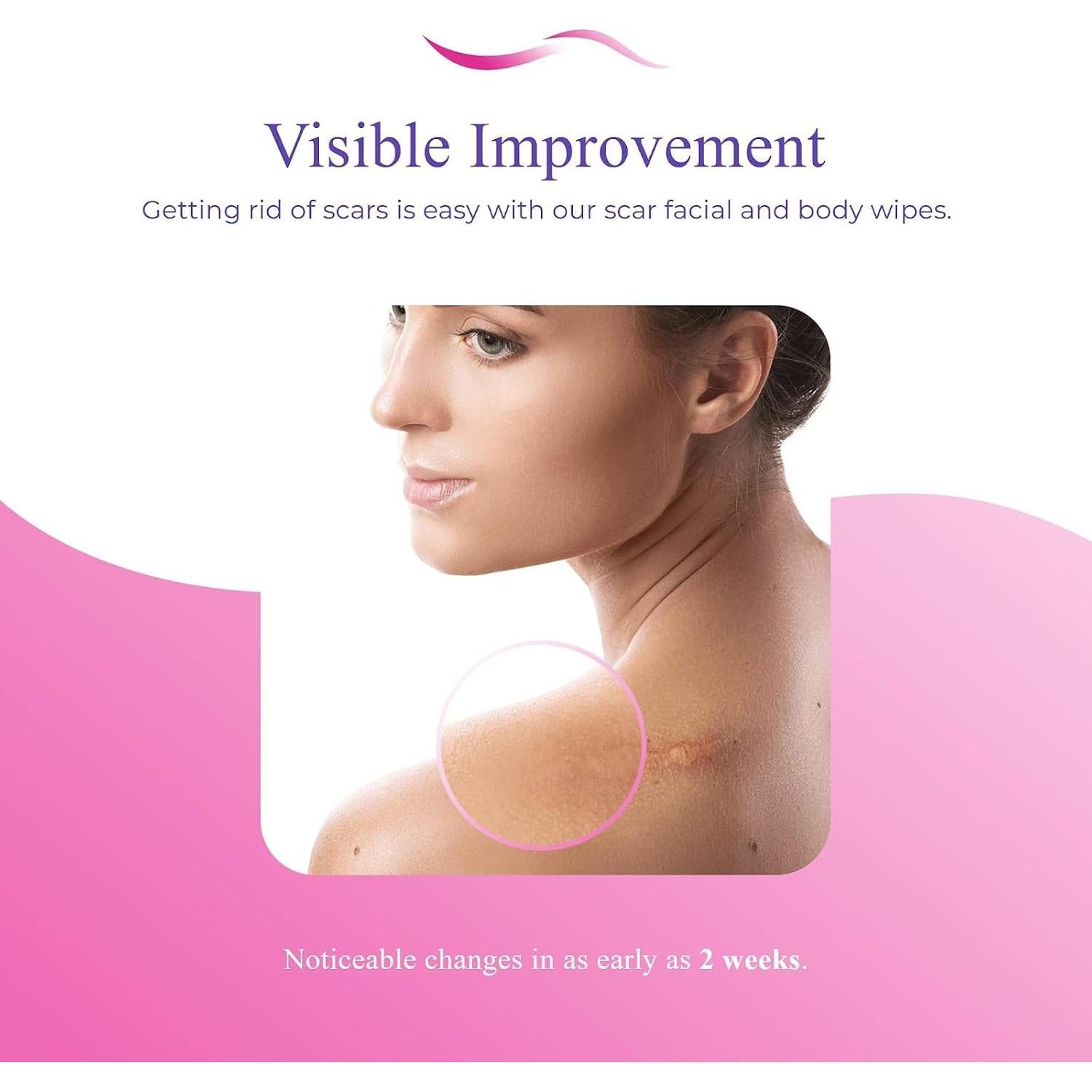 Toallitas Derminish para Cicatrices - Eliminador Natural 170g