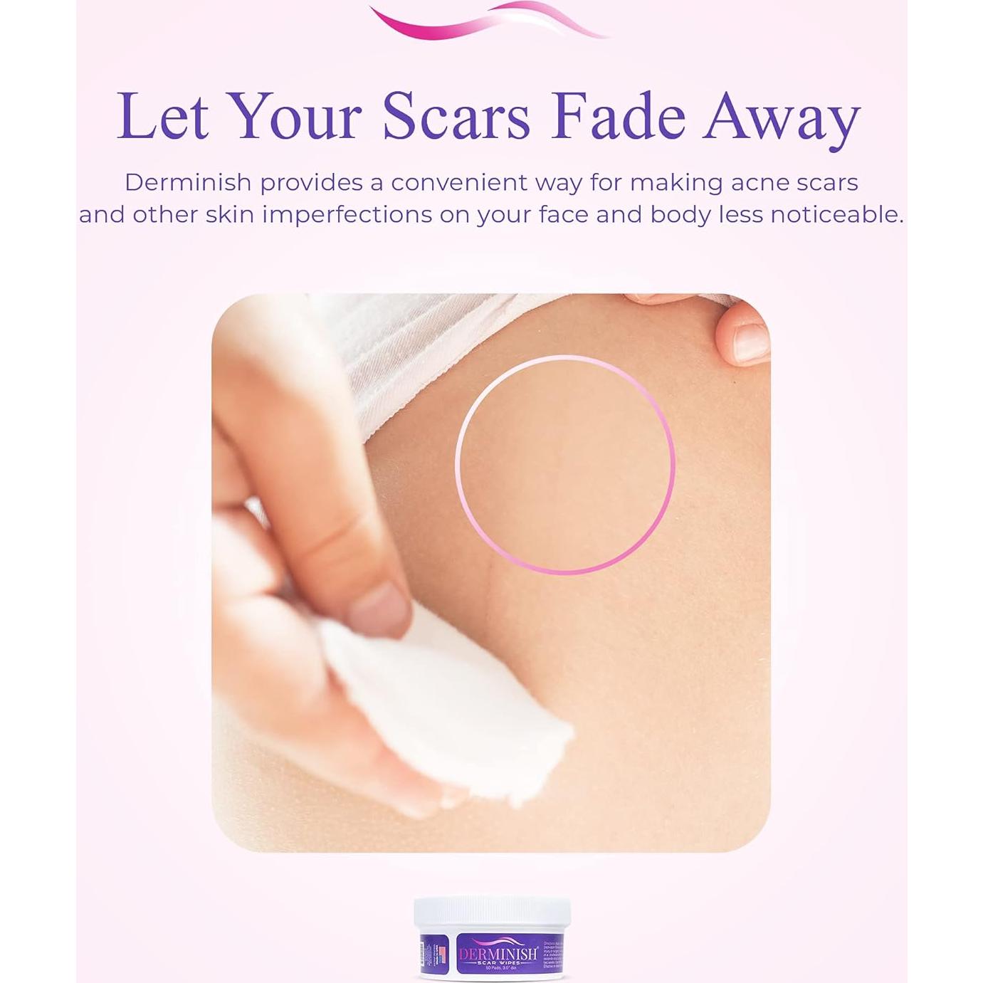 Toallitas Derminish para Cicatrices - Eliminador Natural 170g