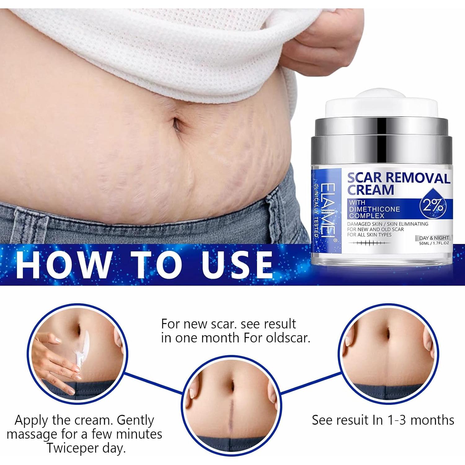 Crema para Cicatrices Writheion 159g - Gel Avanzado para Piel