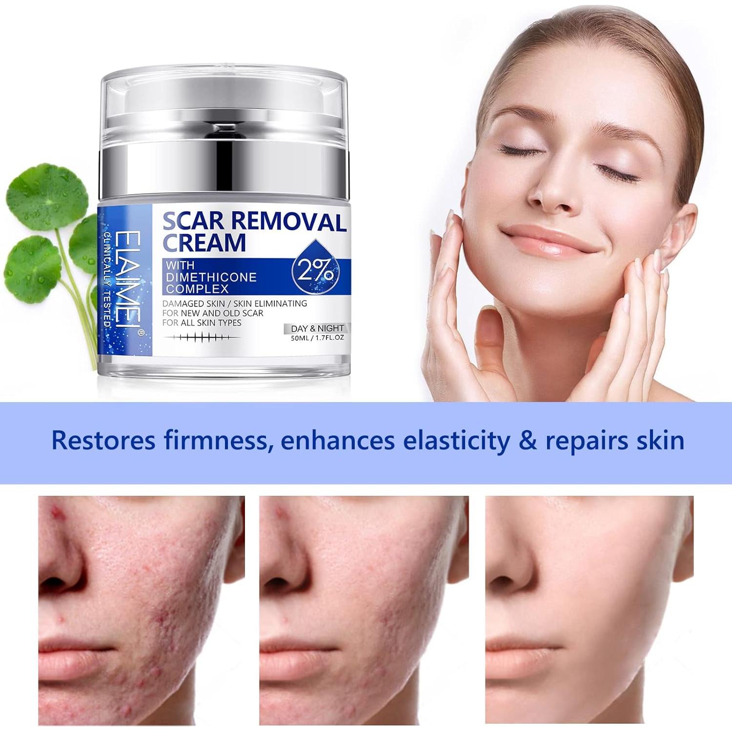 Crema para Cicatrices Writheion 159g - Gel Avanzado para Piel